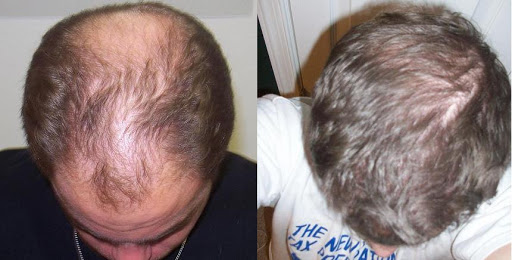 Hair Removal Service «Cosmetic Laser and Beauty Spa», reviews and photos, 3026 Eastpoint Pkwy, Louisville, KY 40223, USA