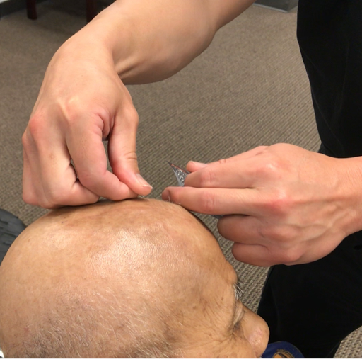 Hope Neuro-Acupuncture Rehab image