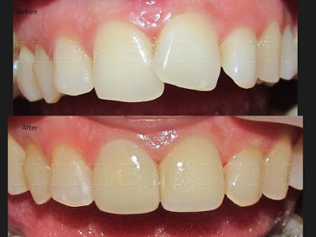 PlanDental - Dentistry Done Right. Dental Clinic, Mahim - PlanDental - Dentistry Done Right. Dental Clinic, Mahim