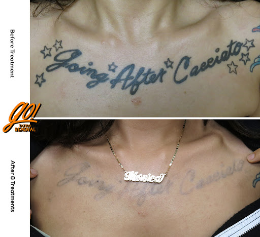 Explore vikings tattoo ideas, creative tattoo ideas in Allentown, available at Removery Tattoo Removal & Fading