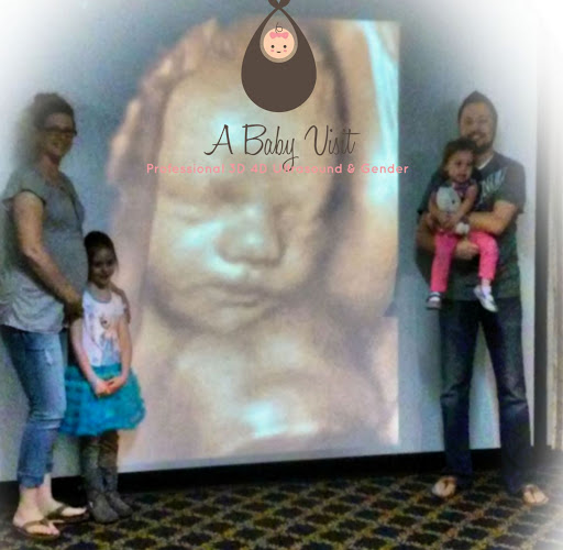 A Baby Visit 3D 4D Ultrasound