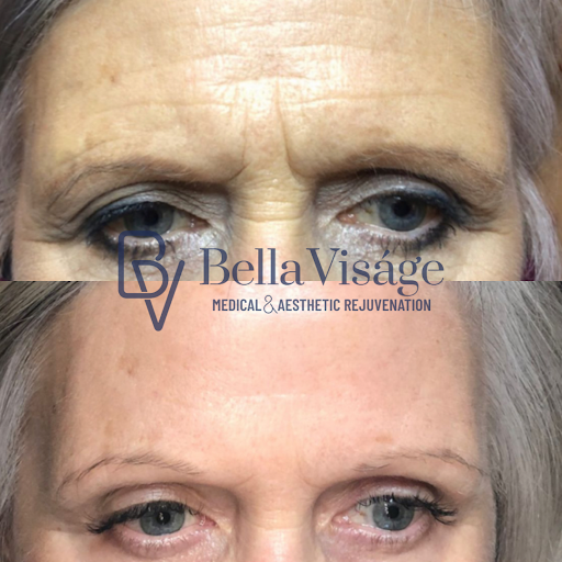 Explore monster tattoo ideas, creative tattoo ideas in Lakeland, available at Bella Visge Medical & Aesthetic Rejuvenation