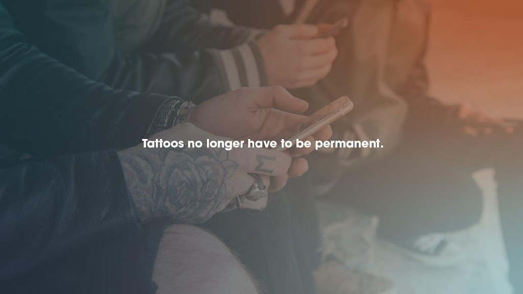 Removery Tattoo Removal & Fading 85225
