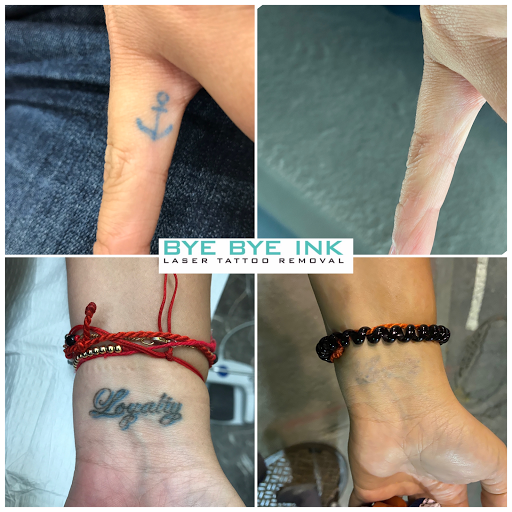 Explore rip neck tattoo ideas, creative tattoo ideas in Middle Village, available at Bye Bye Ink Laser Tattoo Removal