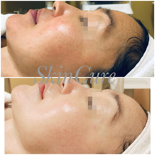 SkinCure K-beauty Spa image
