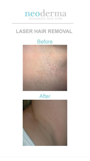 Explore knicks tattoo ideas, creative tattoo ideas in Anaheim, available at Neoderma