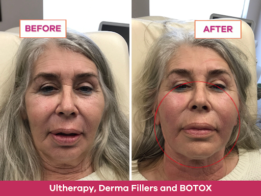 Explore tattoo ideas for childrens names and birthdays, creative tattoo ideas in Cincinnati, available at The Dermatology, Laser & Vein Center