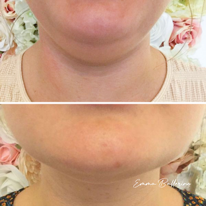 جماليات لا تشوبه شائبة by Emma Ballerino - Flawless Aesthetics by Emma Ballerino