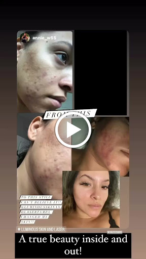 Explore fallen angel tattoo ideas, creative tattoo ideas in Tampa, available at Luminous Skin and Laser