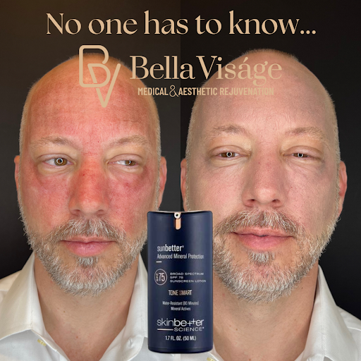 Explore c section scar tattoo ideas, creative tattoo ideas in Lakeland, available at Bella Visge Medical & Aesthetic Rejuvenation