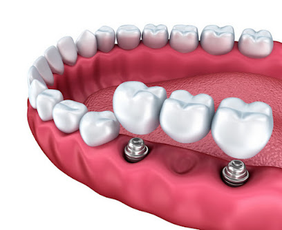 Dental Implants Albany