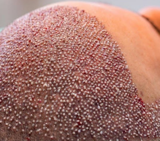 Dr.Özgür Çetiner Güzellik Merkezi