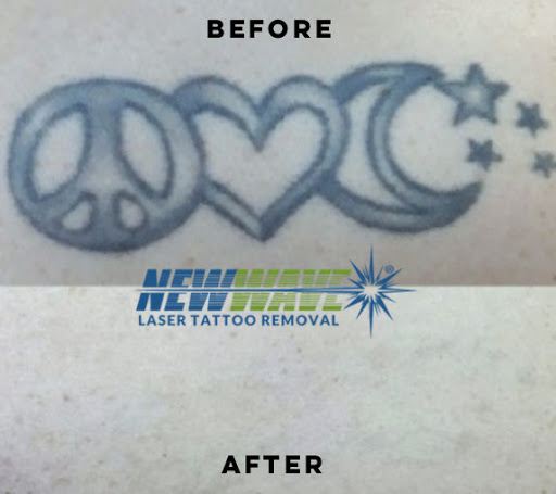 Explore borderline personality disorder tattoo ideas, creative tattoo ideas in Bethlehem, available at New Wave Laser Tattoo Removal