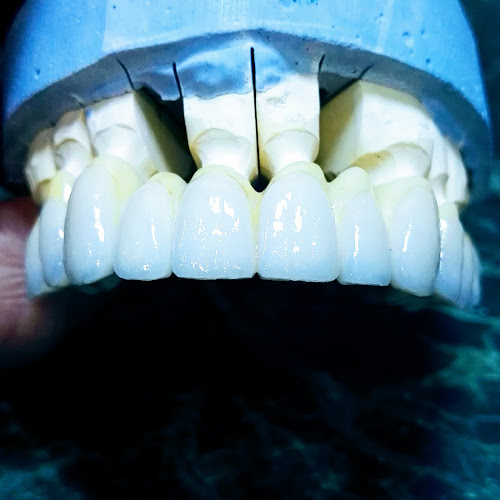 Comentarii opinii despre Tehnician Dentar (technicien dentaire)