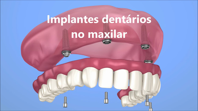 Clinica Dentária Setúbal (Vita Centro) - Setúbal