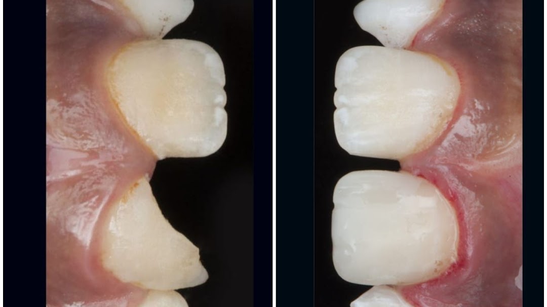 دكتور محمد عمرو الخشاب. المهندسين .Dr Mohamed el Khashab Dental clinic. mohandessin branch