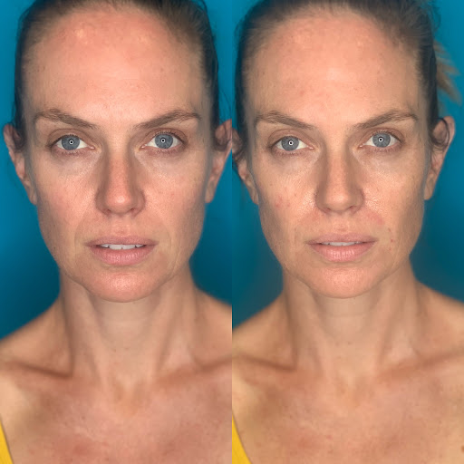 SMOOTH SKIN LOUNGE image