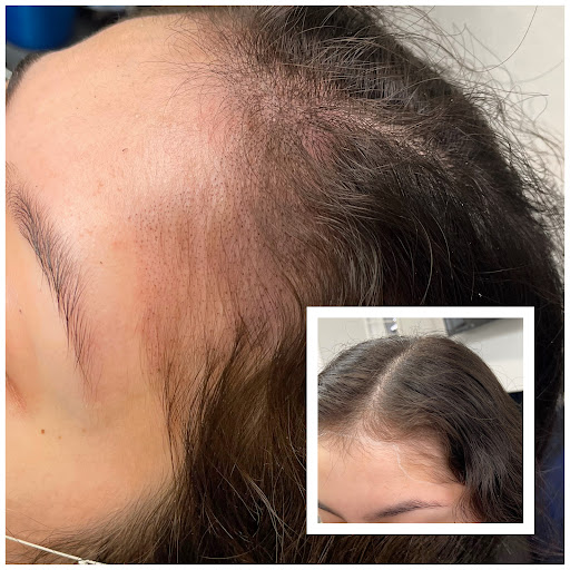 Explore heart tattoo ideas small, creative tattoo ideas in Roseville, available at NuHair Ink. Scalp MicroPigmentation & Aesthetic Clinic of Sacramento