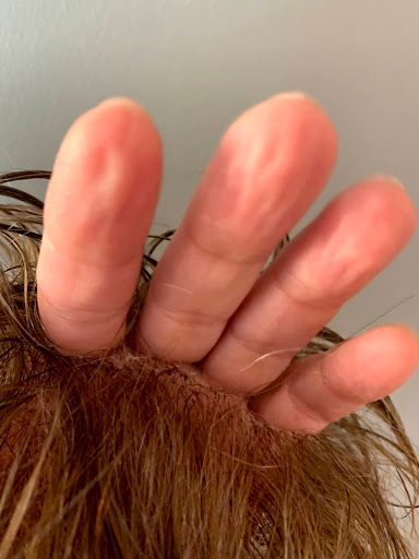 Hair Replacement Service «Hair Club», reviews and photos, 7800 E Orchard Rd Suite 370, Greenwood Village, CO 80111, USA