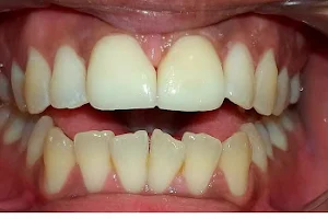 Advanced Dental Clinic Chattarpur - Dr Barkha Aggarwal - Dentist in Chhatarpur - Dentist near me image