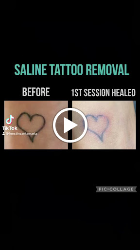 Explore cystic fibrosis tattoos ideas, creative tattoo ideas in South Charleston, available at TORQUE Tattoo