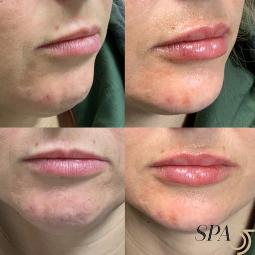 Explore small harry potter tattoo ideas, creative tattoo ideas in Boise, available at Spa 35 Med Spa