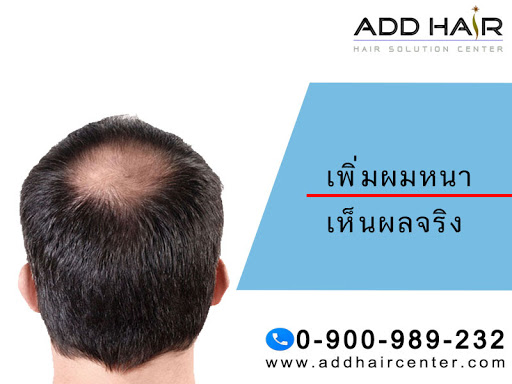 ADDHAIR HAIR SOLUTION CENTER