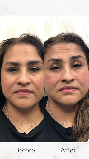 Explore 4 leaf clover tattoo ideas, creative tattoo ideas in Cincinnati, available at The Dermatology, Laser & Vein Center