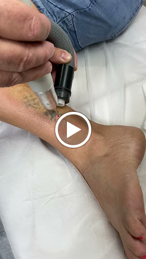 Explore twd tattoo ideas, creative tattoo ideas in Naples, available at Laser Tattoo Removal Services