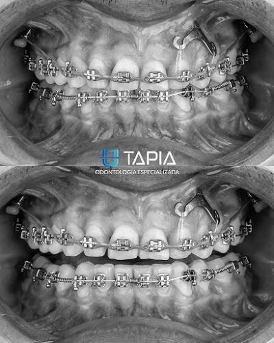Opiniones de Clínica Dental Tapia en Cayma - Dentista