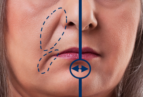 Dr Cosmetic Clinic - Dermal Fillers | Lip Fillers | Botox | Profhilo | PDO Thread Face Lift | Fat Dissolver | Eyelash Serum