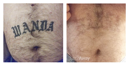 Explore spine tattoo ideas for men, creative tattoo ideas in Huntington, available at Tatt2Away Huntington