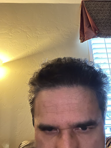 Hair Replacement Service «Medical Hair Transplants & Aesthetics», reviews and photos, 15055 Los Gatos Blvd Suite #110, Los Gatos, CA 95032, USA