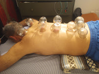 Acupuncture in New York @ Nyhealers - Photo 5 - Car repair in New York, NY, Newark