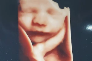 Enso Prenatal & 3D/4D Ultrasounds image