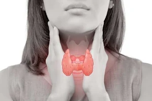Thyroid Treatment Alwar image