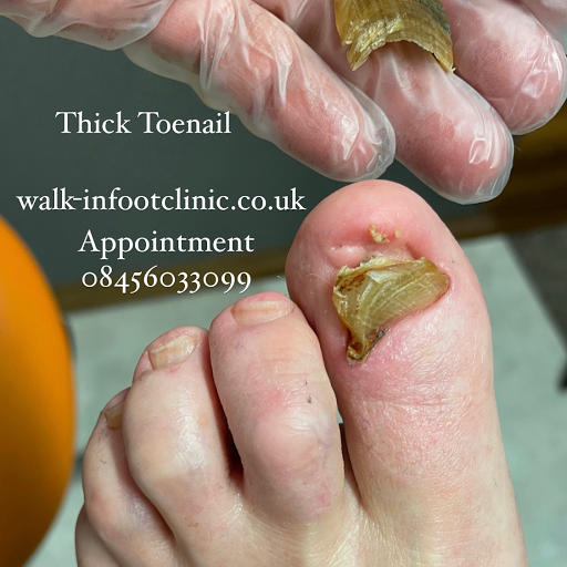 Walk IN Foot Clinic