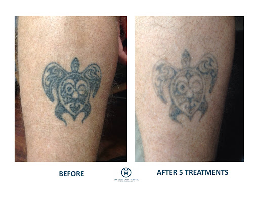 Find female tattoo ideas for women for your next unique tattoo in San Diego at Removery Tattoo Removal & Fading