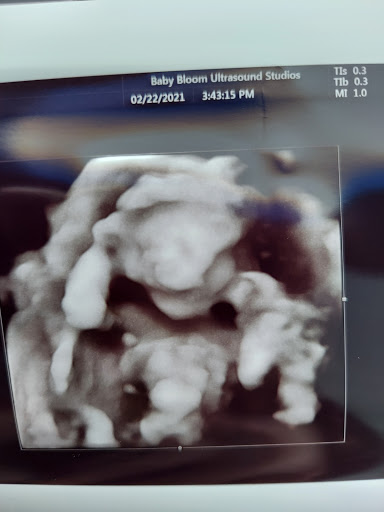 Baby Store «Baby Bloom 4D Ultrasound Studio», reviews and photos, 1803 Canterbury Dr d, Valdosta, GA 31602, USA