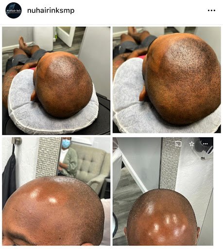 Explore tow truck tattoo ideas, creative tattoo ideas in Roseville, available at NuHair Ink. Scalp MicroPigmentation & Aesthetic Clinic of Sacramento