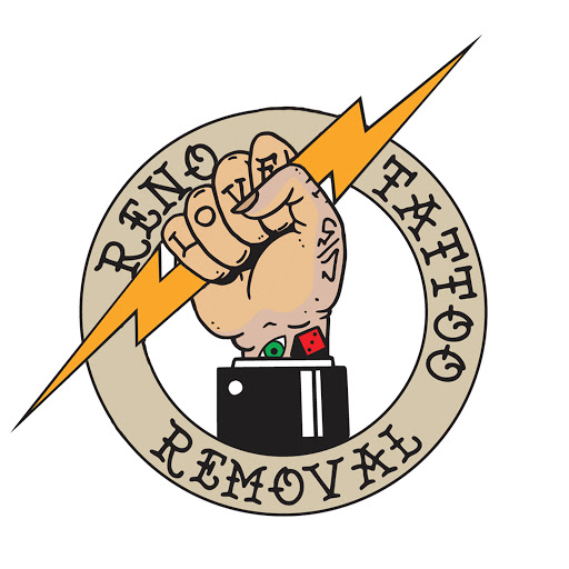 Explore just keep swimming tattoo ideas, creative tattoo ideas in Reno, available at Reno Tattoo Removal