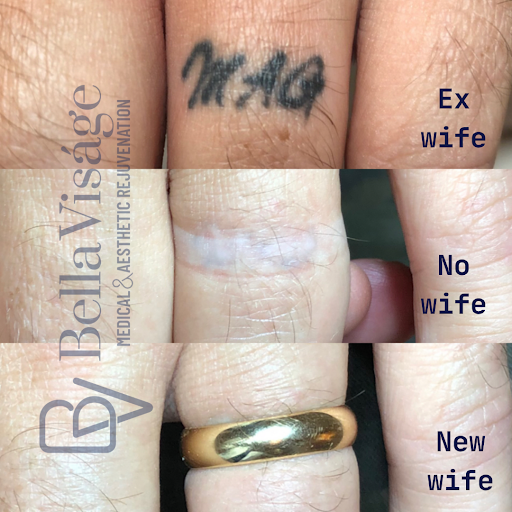 Explore yemaya tattoo ideas, creative tattoo ideas in Lakeland, available at Bella Visge Medical & Aesthetic Rejuvenation