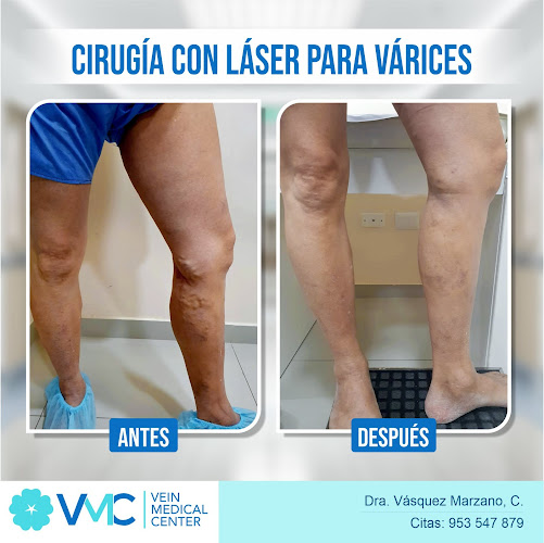 Vein Medical Center- Dra. Cindy Vásquez - Lima