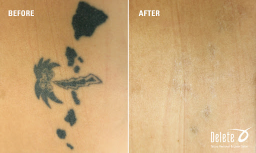 Explore fall tattoo ideas, creative tattoo ideas in Phoenix, available at Removery Tattoo Removal & Fading