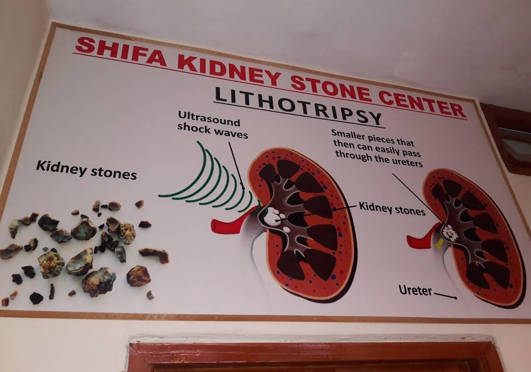 Shifa Kidney Stone Center