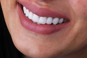 مركزد/ أسامة أبوزيد لتجميل وزراعة الأسنان image