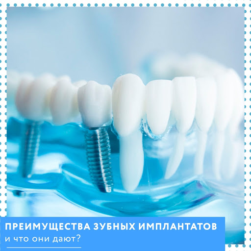 РЦСИ - центр стоматологической имплантации