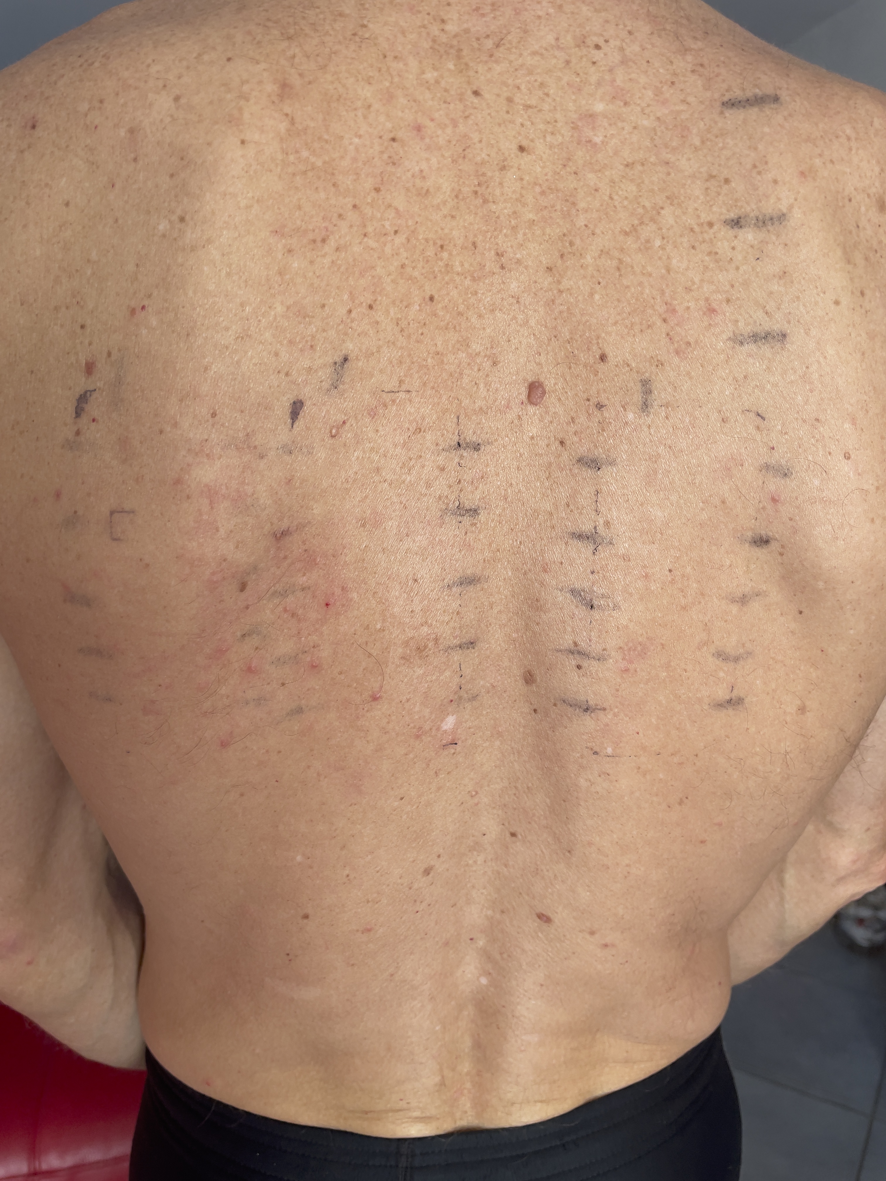 Photo n° 2 de l'avis de Hervé.e fait le 17/11/2023 à 17:10