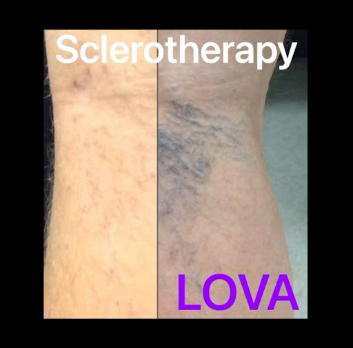 Explore booty tattoo ideas for females, creative tattoo ideas in Lake Oswego, available at Lake Oswego Vein and Aesthetic LOVA