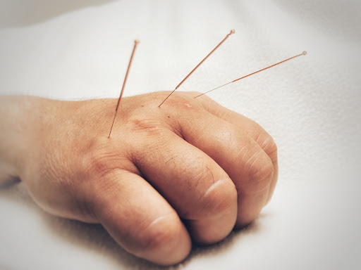 Acupuncture courses Milan